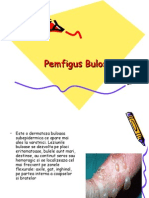 Pemfigus Bulos