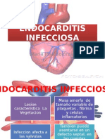 Endocarditis Infecciosa