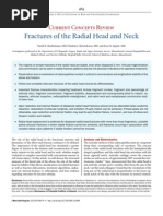 Fractures Radial Head & Neck. JBJS. 2013