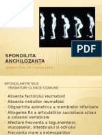 spondilita ankilozanta