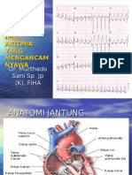 ekg-normalaritmiaima.ppt