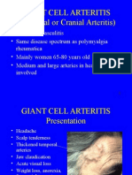 Understanding Giant Cell Arteritis: Symptoms, Diagnosis and Treatment