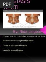 Download Diastasis Recti by JaneAnnCapinding SN258603536 doc pdf