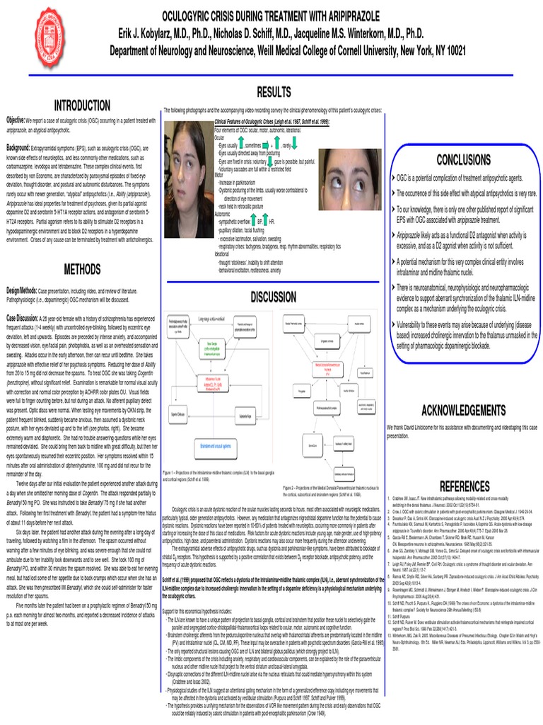 Oculogyric Crisis During Treatment With Aripiprazole Antipsychotic Dystonia
