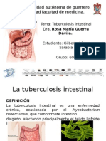 Lopez Sarabia Gilberto-Tuberculosis Intestinal y Peritoneal