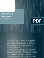 Extractia Dentara