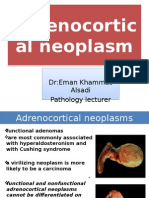 6 Adrenocortical Neoplasm