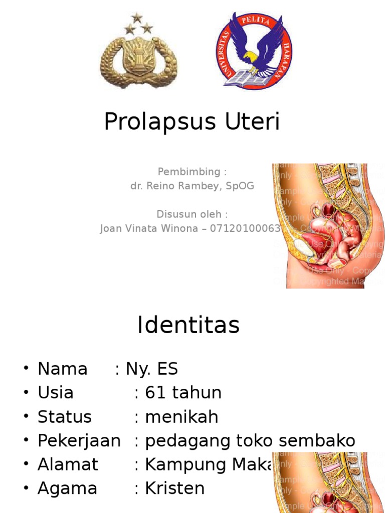 Vaginal prolapsus nimaga oxshaydi?