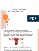 DIU (Dispositivo Intrauterino)