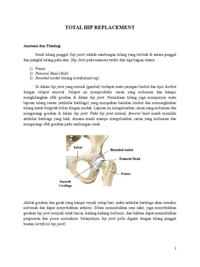 Total Hip Replacement PDF