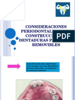 Consideraciones Periodontales en La Construccion de Dentaduras Parciales Removibles