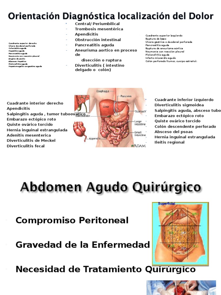 Abdomen Agudo Hemorragico Abdomen Rtt