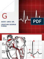 EKG Exemple