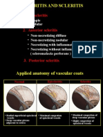 21episcleritis & Scleritis