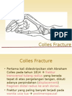 Colles Fracture