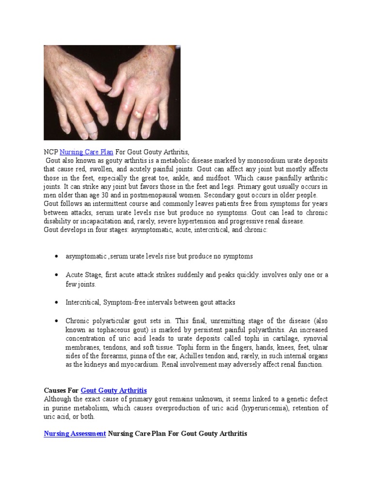 Ncp Nursing Care Plan for Gout Gouty Arthritis Gout Arthritis