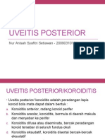 Uveitis Posterior