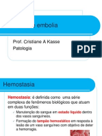 3trombose e Embolia 13 09