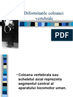 Diformitatile Coloanei