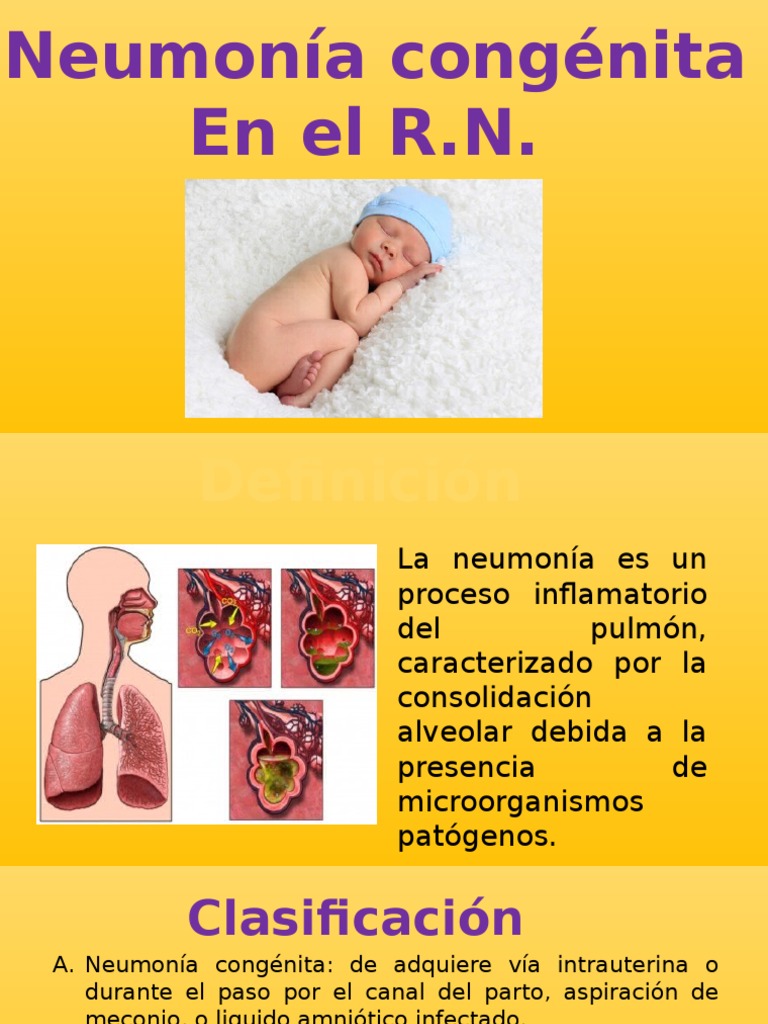 Neumonía Congénita Gpc , Guía de práctica clínica – FHKJ