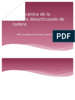 Biomecánica de La Prótesis Desarticulado de Cadera-Lourdes Luna