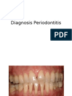 Diagnosis Periodontitis