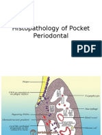 Histopathology of Pocket Periodontal