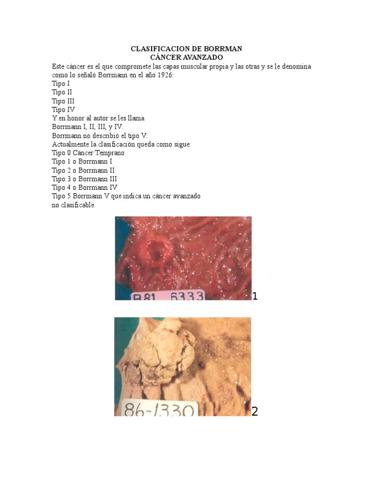 Clasificación de Borrmann en Cáncer Avanzado | PDF | Deportes y ...