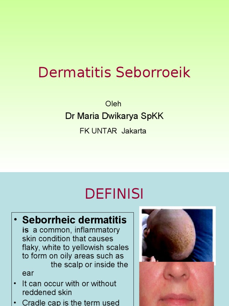 Dermatitis Seborroeik DR Maria Dwikarya SPKK PDF Immunology