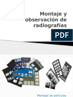 Montaje de Radiografia Bucales