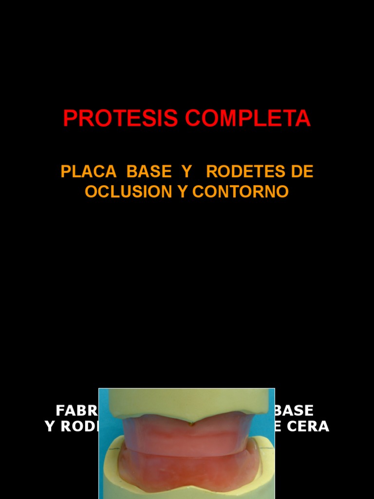 Placas Base y Rodetes en Prótesis Total | PDF | Pintura acrilica ...