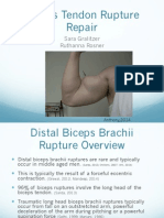 Biceps Brachii Rupture Final
