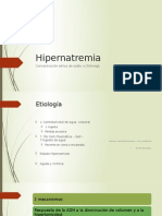 Hipernatremia