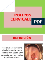 Polipos Cervicales