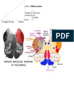 UWORLD- Self Note-- Infarct on Right Posterior Inferior Cerebellar Artery 1