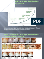 Caria Dentara La Dintii Temp Si Perm Tineri