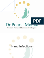 Hand Infection Guide: Felons to Flexor Tenosynovitis