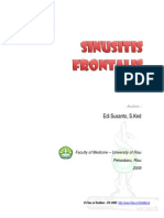 Sinusitis Frontalis Files of Drsmed