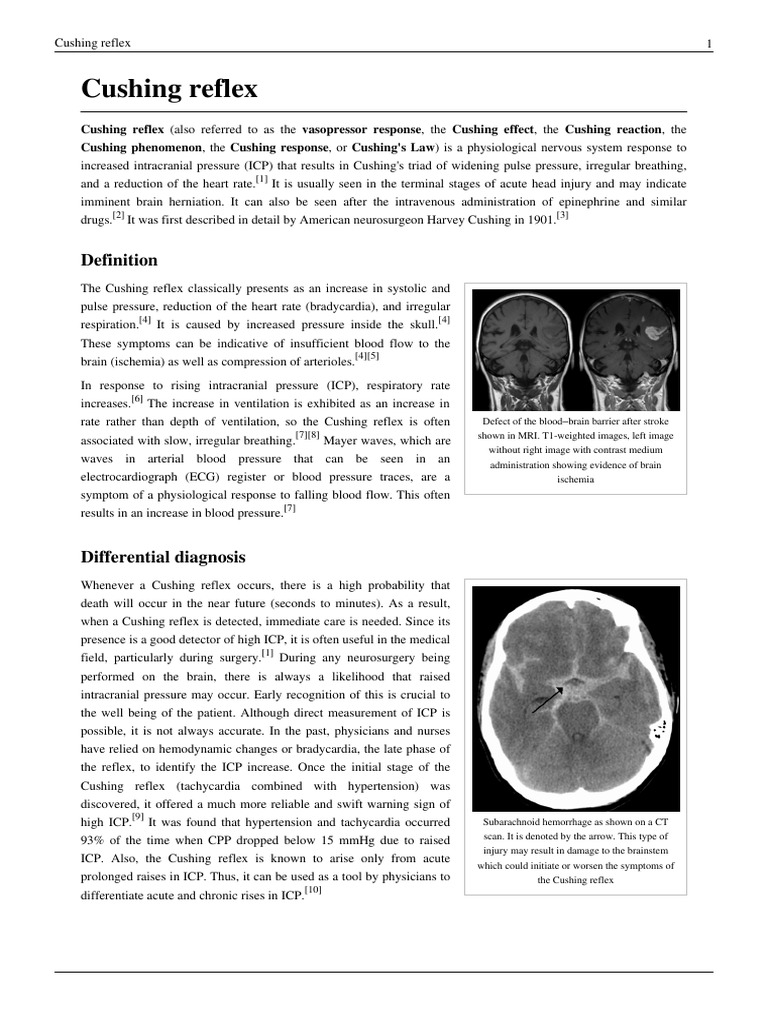Cushing Reflex Circulatory System Cardiovascular Physiology