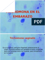 Seminario Trichomona Vaginalis