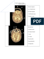 Head and Neck Cross Sections