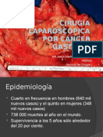 Cirugía Laparoscópica Por Cáncer Gastrico