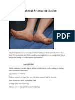 Peripheral Arterial Occlusive Disease: Symptoms