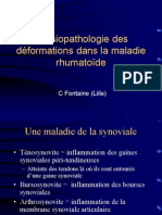 2 - Physiopathologie Des Deformations Rhumatoides