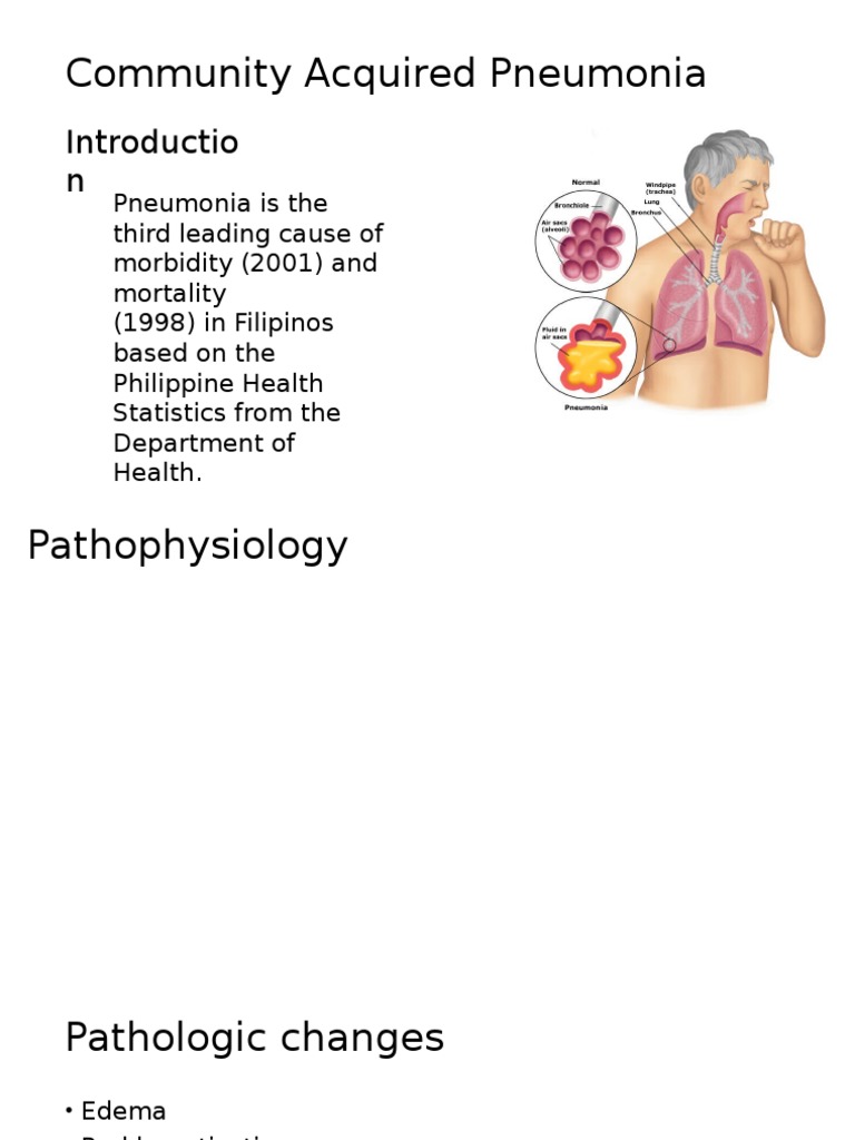 Community Acquired Pneumonia | PDF | Science & Mathematics