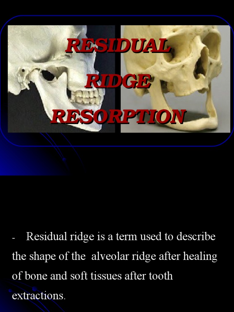 Residual Ridge Resorption Overview | PDF | Dental Implant | Dentures