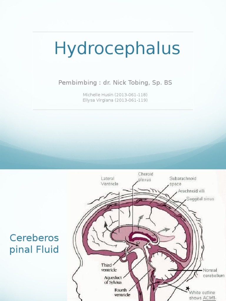 Hydrocephalus | PDF | Cerebrospinal Fluid | Human Head And Neck