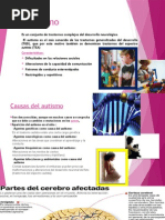 Autismo y Sindrome de Down