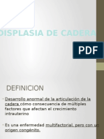 Displasia de cadera: causas, síntomas y tratamiento