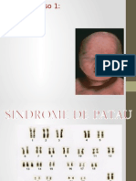 Sindromes Geneticos